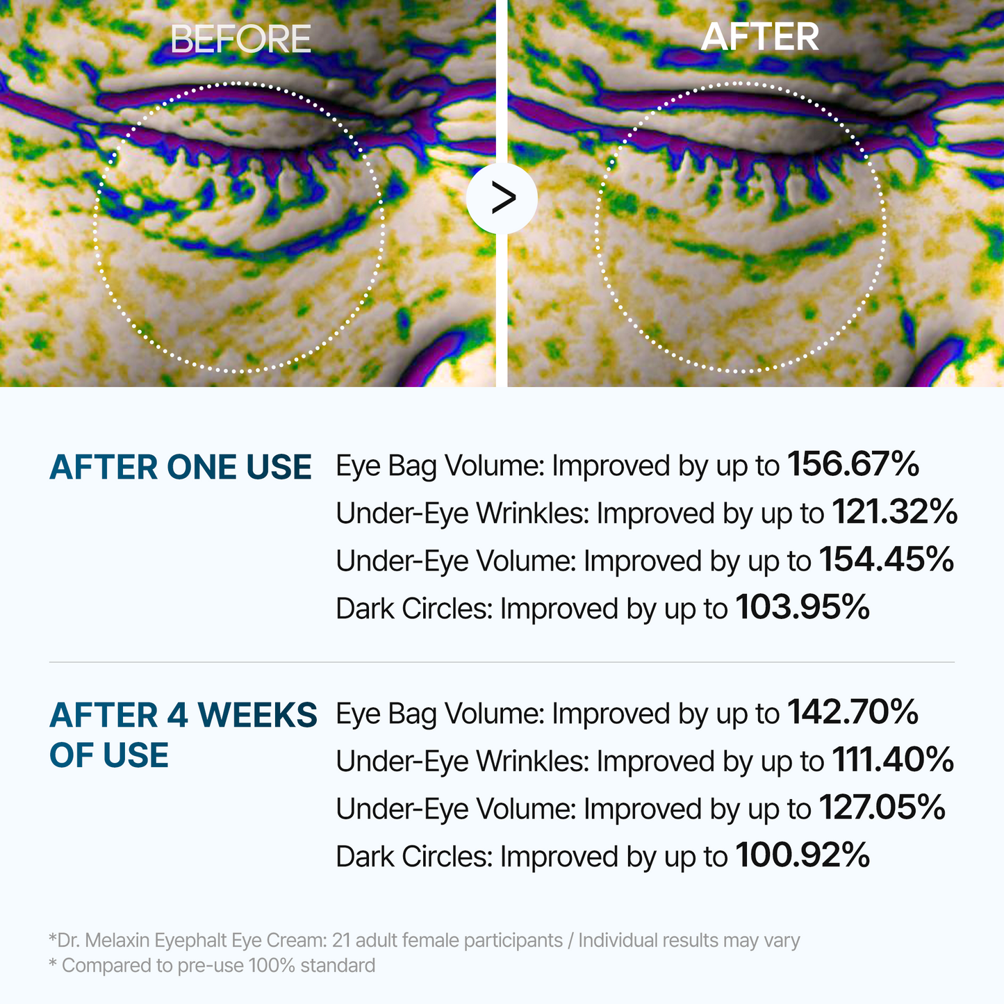 Hearthalo Eyephalt eyebag cream