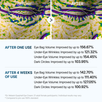 Hearthalo Eyephalt eyebag cream